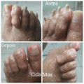podologia-popular-cida-max