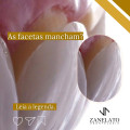 zanelato-estetica-dental-tratamentos-odontologic