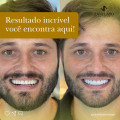 zanelato-estetica-dental-tratamentos-odontologic