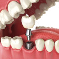 duo-odontologia-humanizada-clinica-odontologica